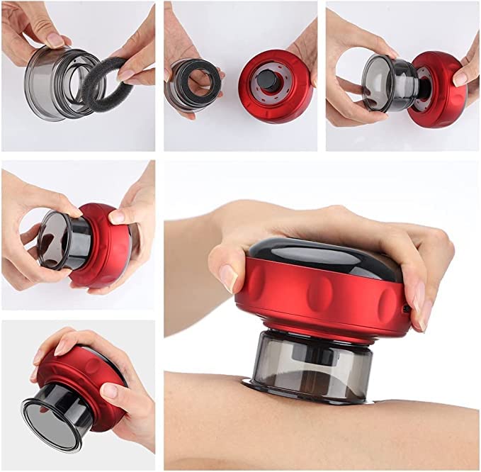 ThermoCup PRO V2 - Electronic Self Cupping Therapy Machine