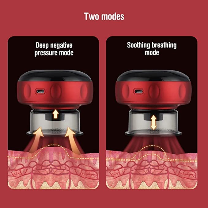 ThermoCup PRO V2 - Electronic Self Cupping Therapy Machine